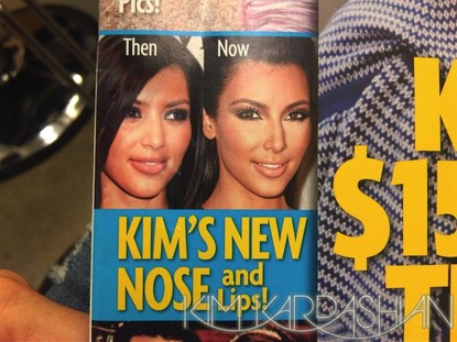 gallery_main-Kim-Kardashian-Nose-Lip-Surgery-Star-2